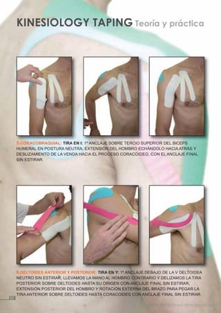 Kinesiotape
