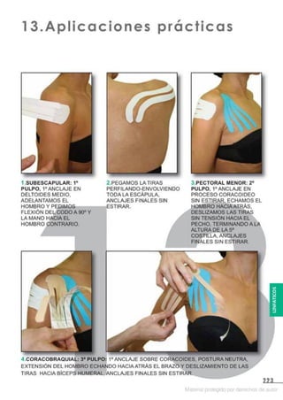 Kinesiotape