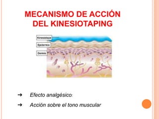 MECANISMO DE ACCIÓN 
DEL KINESIOTAPING 
➔ Efecto analgésico: 
➔ Acción sobre el tono muscular 
 