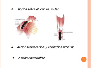 ➔ Acción sobre el tono muscular 
➔ Acción biomecánica, y corrección articular: 
➔ Acción neurorrefleja 
 
