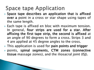  Space tape describes an application that is affixed
over a point in a cross or star shape using tapes of
the same length.
 Each tape is affixed en bloc with maximum tension.
In general, four strips are used for a star. After
affixing the first tape strip, the second is affixed at
an angle of 90 degrees to form a cross. Strips 3 and
4 are applied at 45 degree angles to the cross.
 This application is used for pain points and trigger
 points, spinal segments, CTM zones (connective
tissue massage zones), and the iliosacral joint (ISJ).
 