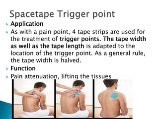  Application
 As with a pain point, 4 tape strips are used for
the treatment of trigger points. The tape width
as well as the tape length is adapted to the
location of the trigger point. As a general rule,
the tape width is halved.
 Function
 Pain attenuation, lifting the tissues
 