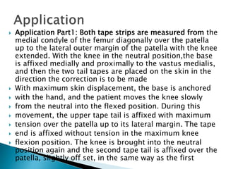  Application Part1: Both tape strips are measured from the
medial condyle of the femur diagonally over the patella
up to the lateral outer margin of the patella with the knee
extended. With the knee in the neutral position,the base
is affixed medially and proximally to the vastus medialis,
and then the two tail tapes are placed on the skin in the
direction the correction is to be made
 With maximum skin displacement, the base is anchored
 with the hand, and the patient moves the knee slowly
 from the neutral into the flexed position. During this
 movement, the upper tape tail is affixed with maximum
 tension over the patella up to its lateral margin. The tape
 end is affixed without tension in the maximum knee
 flexion position. The knee is brought into the neutral
position again and the second tape tail is affixed over the
patella, slightly off set, in the same way as the first
 