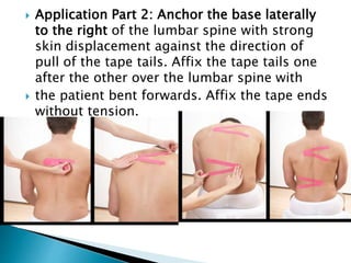  Application Part 2: Anchor the base laterally
to the right of the lumbar spine with strong
skin displacement against the direction of
pull of the tape tails. Affix the tape tails one
after the other over the lumbar spine with
 the patient bent forwards. Affix the tape ends
without tension.
 
