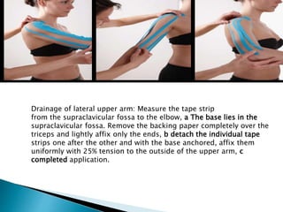 Drainage of lateral upper arm: Measure the tape strip
from the supraclavicular fossa to the elbow, a The base lies in the
supraclavicular fossa. Remove the backing paper completely over the
triceps and lightly affix only the ends, b detach the individual tape
strips one after the other and with the base anchored, affix them
uniformly with 25% tension to the outside of the upper arm, c
completed application.
 