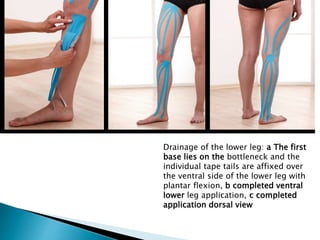 Drainage of the lower leg: a The first
base lies on the bottleneck and the
individual tape tails are affixed over
the ventral side of the lower leg with
plantar flexion, b completed ventral
lower leg application, c completed
application dorsal view
 