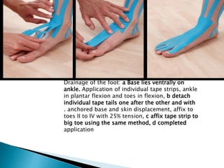 Drainage of the foot: a Base lies ventrally on
ankle. Application of individual tape strips, ankle
in plantar flexion and toes in flexion, b detach
individual tape tails one after the other and with
. anchored base and skin displacement, affix to
toes II to IV with 25% tension, c affix tape strip to
big toe using the same method, d completed
application
 