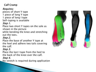 Requires;
pieces of short Y tape
1 piece of long Y tape
1 piece of long I tape
Self-taping is available
Step 1.
Place two short Y tapes on the sole as
shown in the picture
while bending the knee and stretching
out the toes.
Step 2.
Place the base of another Y tape at
the heel and adhere two tails covering
the calf.
Step 3.
Place the last I tape from the heel to
the back of the knee over the calf.
Step 4.
No stretch is required during application
Calf Cramp
 