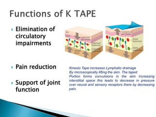  Elimination of
circulatory
impairments
 Pain reduction
 Support of joint
function
Kinesio Tape increases Lymphatic drainage
By microscopically lifting the skin. The taped
Portion forms convulsions in the skin increasing
interstitial space this leads to decrease in pressure
over neural and sensory receptors there by decreasing
pain.
 