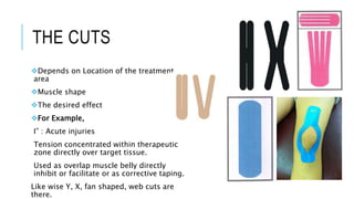 THE CUTS
Depends on Location of the treatment
area
Muscle shape
The desired effect
For Example,
I” : Acute injuries
Tension concentrated within therapeutic
zone directly over target tissue.
Used as overlap muscle belly directly
inhibit or facilitate or as corrective taping.
Like wise Y, X, fan shaped, web cuts are
there.
 