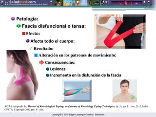 Copyright © 2015 Edgar Lopategui Corsino | Saludmed
NOTA. Adaptado de: Manual of Kinesiological Taping: an Epitome of Kinesiology Taping Techniques. (p. 5), por P. Jain, 2012, India:
CPSTA. Copyright 2012 por: P. Jain.
Patología:
Fascia disfuncional o tensa:
Efecto:
Afecta todo el cuerpo:
Resultado:
Resultado:
Alteraci
Alteració
ón en los patrones de movimiento:
n en los patrones de movimiento:
Consecuencias:
Consecuencias:
Lesiones
Lesiones
Incremento en la disfunci
Incremento en la disfunció
ón de la
n de la fascia
fascia
 