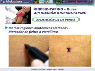 Copyright © 2015 Edgar Lopategui Corsino | Saludmed
KINESIO
KINESIO-
-TAPING
TAPING –
– Gu
Guí
ías
as
APLICACI
APLICACIÓ
ÓN KINESIO
N KINESIO-
-TAPING
TAPING
APLICACI
APLICACIÓ
ÓN DE LA VENDA
N DE LA VENDA
Marcar
Marcar regiones
regiones anat
anató
ómicas
micas afectadas
afectadas –
–
Marcador
Marcador de
de fieltro
fieltro o
o estrellitas
estrellitas:
:
 