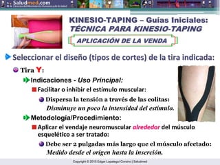 Copyright © 2015 Edgar Lopategui Corsino | Saludmed
KINESIO
KINESIO-
-TAPING
TAPING –
– Gu
Guí
ías Iniciales:
as Iniciales:
T
TÉ
ÉCNICA PARA KINESIO
CNICA PARA KINESIO-
-TAPING
TAPING
APLICACI
APLICACIÓ
ÓN DE LA VENDA
N DE LA VENDA
Seleccionar
Seleccionar el
el dise
diseñ
ño
o (
(tipos
tipos de
de cortes
cortes) de la
) de la tira
tira indicada
indicada:
:
Tira Y:
Indicaciones - Uso Principal:
Facilitar o inhibir el estímulo muscular:
Disminuye un poco la intensidad del estímulo.
Dispersa la tensión a través de las colitas:
Metodología/Procedimiento:
Aplicar el vendaje neuromuscular alrededor
alrededor del músculo
esquelético a ser tratado:
Medido desde el origen hasta la inserción.
Debe ser 2 pulgadas más largo que el músculo afectado:
 