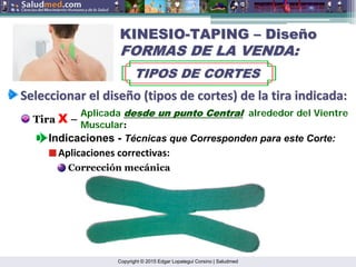Copyright © 2015 Edgar Lopategui Corsino | Saludmed
Seleccionar
Seleccionar el
el dise
diseñ
ño
o (
(tipos
tipos de
de cortes
cortes) de la
) de la tira
tira indicada
indicada:
:
Tira X –
Indicaciones - Técnicas que Corresponden para este Corte:
Aplicada desde
desde un
un punto
punto Central
Central alrededor del Vientre
Muscular:
Aplicaciones correctivas:
Corrección mecánica
KINESIO
KINESIO-
-TAPING
TAPING –
– Dise
Diseñ
ño
o
FORMAS DE LA VENDA:
FORMAS DE LA VENDA:
TIPOS DE CORTES
TIPOS DE CORTES
 