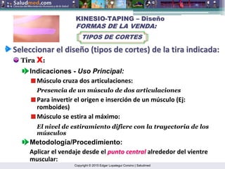 Copyright © 2015 Edgar Lopategui Corsino | Saludmed
Seleccionar
Seleccionar el
el dise
diseñ
ño
o (
(tipos
tipos de
de cortes
cortes) de la
) de la tira
tira indicada
indicada:
:
Tira X:
Indicaciones - Uso Principal:
Músculo cruza dos articulaciones:
Músculo se estira al máximo:
Para invertir el origen e inserción de un músculo (Ej:
romboides)
El nivel de estiramiento difiere con la trayectoria de los
músculos
Presencia de un músculo de dos articulaciones
KINESIO
KINESIO-
-TAPING
TAPING –
– Dise
Diseñ
ño
o
FORMAS DE LA VENDA:
FORMAS DE LA VENDA:
TIPOS DE CORTES
TIPOS DE CORTES
Metodología/Procedimiento:
Aplicar el vendaje desde el punto central
punto central alrededor del vientre
muscular:
 