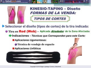 Copyright © 2015 Edgar Lopategui Corsino | Saludmed
KINESIO
KINESIO-
-TAPING
TAPING –
– Dise
Diseñ
ño
o
FORMAS DE LA VENDA:
FORMAS DE LA VENDA:
TIPOS DE CORTES
TIPOS DE CORTES
Seleccionar
Seleccionar el
el dise
diseñ
ño
o (
(tipos
tipos de
de cortes
cortes) de la
) de la tira
tira indicada
indicada:
:
Tira en Red (Web) –
Indicaciones - Técnicas que Corresponden para este Corte:
Aplicada Alrededor
Alrededor de la Zona Afectada:
Aplicaciones Ligamentosas:
Técnica de vendaje de espacio
Aplicaciones Linfáticas
 