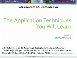 Copyright © 2015 Edgar Lopategui Corsino | Saludmed
APLICACIONES DEL KINESIOTAPING
NOTA. Reproducido de: Kinesiology Taping: Neuro-Structural Taping
Technique [DVD], por Collaborans Inc, 2012, Toronto, Canada: Collaborans Inc.
Copyright 2012 por: COLLABORANS INC. Ir a NSTT: http://www.nstaping.com
 