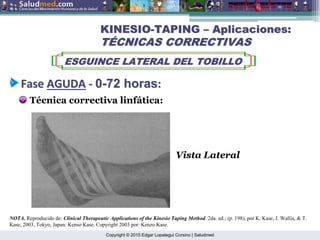 Copyright © 2015 Edgar Lopategui Corsino | Saludmed
Técnica correctiva linfática:
KINESIO
KINESIO-
-TAPING
TAPING –
– Aplicaciones:
Aplicaciones:
T
TÉ
ÉCNICAS CORRECTIVAS
CNICAS CORRECTIVAS
ESGUINCE LATERAL DEL TOBILLO
ESGUINCE LATERAL DEL TOBILLO
Fase
Fase AGUDA
AGUDA ‐
‐ 0
0-
-72
72 horas
horas:
:
NOTA. Reproducido de: Clinical Therapeutic Applications of the Kinesio Taping Method. 2da. ed.; (p. 198), por K. Kase, J. Wallis, & T.
Kase, 2003, Tokyo, Japan: Kenso Kase. Copyright 2003 por: Kenzo Kase.
Vista Lateral
 