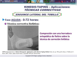Copyright © 2015 Edgar Lopategui Corsino | Saludmed
Técnica correctiva linfática:
KINESIO
KINESIO-
-TAPING
TAPING –
– Aplicaciones:
Aplicaciones:
T
TÉ
ÉCNICAS CORRECTIVAS
CNICAS CORRECTIVAS
ESGUINCE LATERAL DEL TOBILLO
ESGUINCE LATERAL DEL TOBILLO
Fase
Fase AGUDA
AGUDA ‐
‐ 0
0-
-72
72 horas
horas:
:
NOTA. Reproducido de: Clinical Therapeutic Applications of the Kinesio Taping Method. 2da. ed.; (p. 198), por K. Kase, J. Wallis, & T.
Kase, 2003, Tokyo, Japan: Kenso Kase. Copyright 2003 por: Kenzo Kase.
Compresión con una herradura
ortopédica de fieltro sobre la
técnica de correción linfática
 