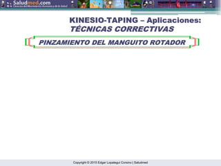 Copyright © 2015 Edgar Lopategui Corsino | Saludmed
KINESIO
KINESIO-
-TAPING
TAPING –
– Aplicaciones:
Aplicaciones:
T
TÉ
ÉCNICAS CORRECTIVAS
CNICAS CORRECTIVAS
PINZAMIENTO DEL MANGUITO ROTADOR
PINZAMIENTO DEL MANGUITO ROTADOR
 