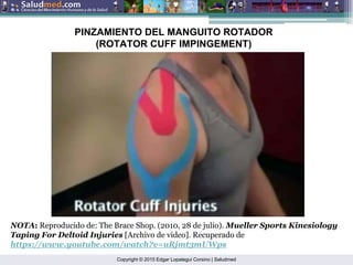 Copyright © 2015 Edgar Lopategui Corsino | Saludmed
NOTA: Reproducido de: The Brace Shop. (2010, 28 de julio). Mueller Sports Kinesiology
Taping For Deltoid Injuries [Archivo de video]. Recuperado de
https://www.youtube.com/watch?v=uRjmt3mUWps
PINZAMIENTO DEL MANGUITO ROTADOR
(ROTATOR CUFF IMPINGEMENT)
 