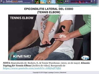 Copyright © 2015 Edgar Lopategui Corsino | Saludmed
NOTA: Reproducido de: Beckers, S., & Tennis Warehouse. (2010, 20 de mayo). Kinesio
Taping for Tennis Elbow [Archivo de video]. Recuperado de
https://www.youtube.com/watch?v=ZdkfmfPNfjQ
EPICONDILITIS LATERAL DEL CODO
(TENNIS ELBOW)
 