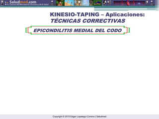 Copyright © 2015 Edgar Lopategui Corsino | Saludmed
KINESIO
KINESIO-
-TAPING
TAPING –
– Aplicaciones:
Aplicaciones:
T
TÉ
ÉCNICAS CORRECTIVAS
CNICAS CORRECTIVAS
EPICONDILITIS MEDIAL DEL CODO
EPICONDILITIS MEDIAL DEL CODO
 