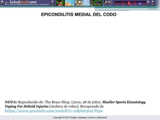 Copyright © 2015 Edgar Lopategui Corsino | Saludmed
NOTA: Reproducido de: The Brace Shop. (2010, 28 de julio). Mueller Sports Kinesiology
Taping For Deltoid Injuries [Archivo de video]. Recuperado de
https://www.youtube.com/watch?v=uRjmt3mUWps
EPICONDILITIS MEDIAL DEL CODO
 