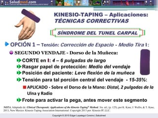 Copyright © 2015 Edgar Lopategui Corsino | Saludmed
SEGUNDO VENDAJE - Dorso de la Muñeca:
CORTE en I: 4 – 6 pulgadas de largo
Posición del paciente: Leve flexión de la muñeca
KINESIO
KINESIO-
-TAPING
TAPING –
– Aplicaciones:
Aplicaciones:
T
TÉ
ÉCNICAS CORRECTIVAS
CNICAS CORRECTIVAS
S
SÍ
ÍNDROME DEL TUNEL CARPAL
NDROME DEL TUNEL CARPAL
NOTA. Adaptado de: Clinical Therapeutic Applications of the Kinesio Taping®
Method. 3ra. ed.; (p. 125), por K. Kase, J. Wallis, & T. Kase,
2013, New Mexico: Kinesio Taping Association International. Copyright 2013 por: Kinesio IP, LLC.
Tensión para tal porción central del vendaje - 15-35%:
APLICADO ‐ Sobre el Dorso de la Mano: Distal, 2 pulgadas de la
Rasgar papel de protección: Medio del vendaje
Ulna y Radio
Frote para activar la pega, antes mover este segmento
OPCI
OPCIÓ
ÓN 1
N 1 –
– Tensi
Tensió
ón
n:
: Correcci
Correcció
ón
n de
de Espacio
Espacio -
- Medio
Medio Tira
Tira I:
I:
 