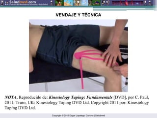 Copyright © 2015 Edgar Lopategui Corsino | Saludmed
NOTA. Reproducido de: Kinesiology Taping: Fundamentals [DVD], por C. Paul,
2011, Truro, UK: Kinesiology Taping DVD Ltd. Copyright 2011 por: Kinesiology
Taping DVD Ltd.
VENDAJE Y TÉCNICA
 