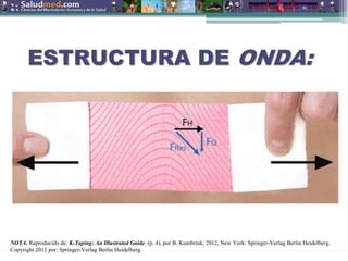 Copyright © 2015 Edgar Lopategui Corsino | Saludmed
ESTRUCTURA DE
ESTRUCTURA DE ONDA:
ONDA:
NOTA. Reproducido de: K-Taping: An Illustrated Guide. (p. 4), por B. Kumbrink, 2012, New York: Springer-Verlag Berlin Heidelberg.
Copyright 2012 por: Springer-Verlag Berlin Heidelberg.
 