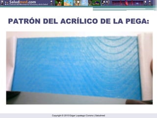 Copyright © 2015 Edgar Lopategui Corsino | Saludmed
PATR
PATRÓ
ÓN DEL ACR
N DEL ACRÍ
ÍLICO DE LA PEGA:
LICO DE LA PEGA:
 