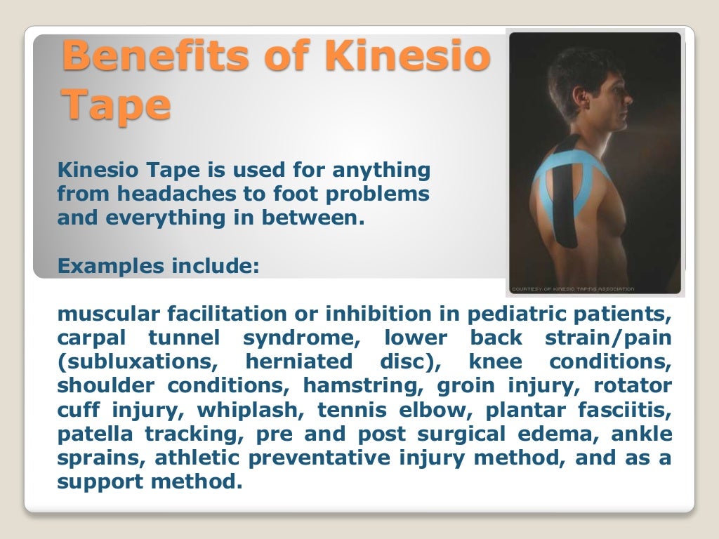 Kinesio taping as a new technique in physiotherapy