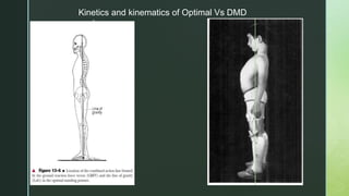 Kinetics and kinematics of posture in DMD | PPTX