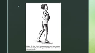 Kinetics and kinematics of posture in DMD | PPTX