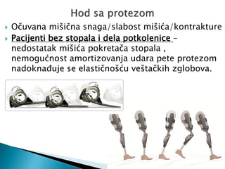  Očuvana mišična snaga/slabost mišića/kontrakture
 Pacijenti bez stopala i dela potkolenice –
nedostatak mišića pokretača stopala ,
nemogućnost amortizovanja udara pete protezom
nadoknađuje se elastičnošću veštačkih zglobova.
 