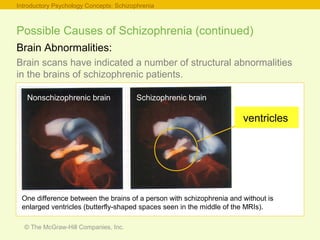 © The McGraw-Hill Companies, Inc.
Possible Causes of Schizophrenia (continued)
Brain Abnormalities:
Brain scans have indicated a number of structural abnormalities
in the brains of schizophrenic patients.
Introductory Psychology Concepts: Schizophrenia
One difference between the brains of a person with schizophrenia and without is
enlarged ventricles (butterfly-shaped spaces seen in the middle of the MRIs).
Schizophrenic brainNonschizophrenic brain
ventricles
 