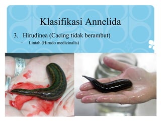 Klasifikasi Annelida
3. Hirudinea (Cacing tidak berambut)
– Lintah (Hirudo medicinalis)
 
