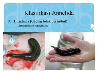 Klasifikasi Annelida
3. Hirudinea (Cacing tidak berambut)
– Lintah (Hirudo medicinalis)
 