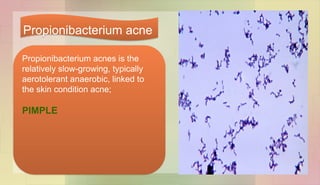 Propionibacterium acnes is the
relatively slow-growing, typically
aerotolerant anaerobic, linked to
the skin condition acne;
PIMPLE
Propionibacterium acne
 
