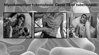 Mycobacterium tuberculosis- Cause TB or tuberculosis
 