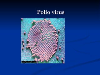 Polio virus 