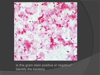 Is this gram stain positive or negative?
Identify the bacteria.
 