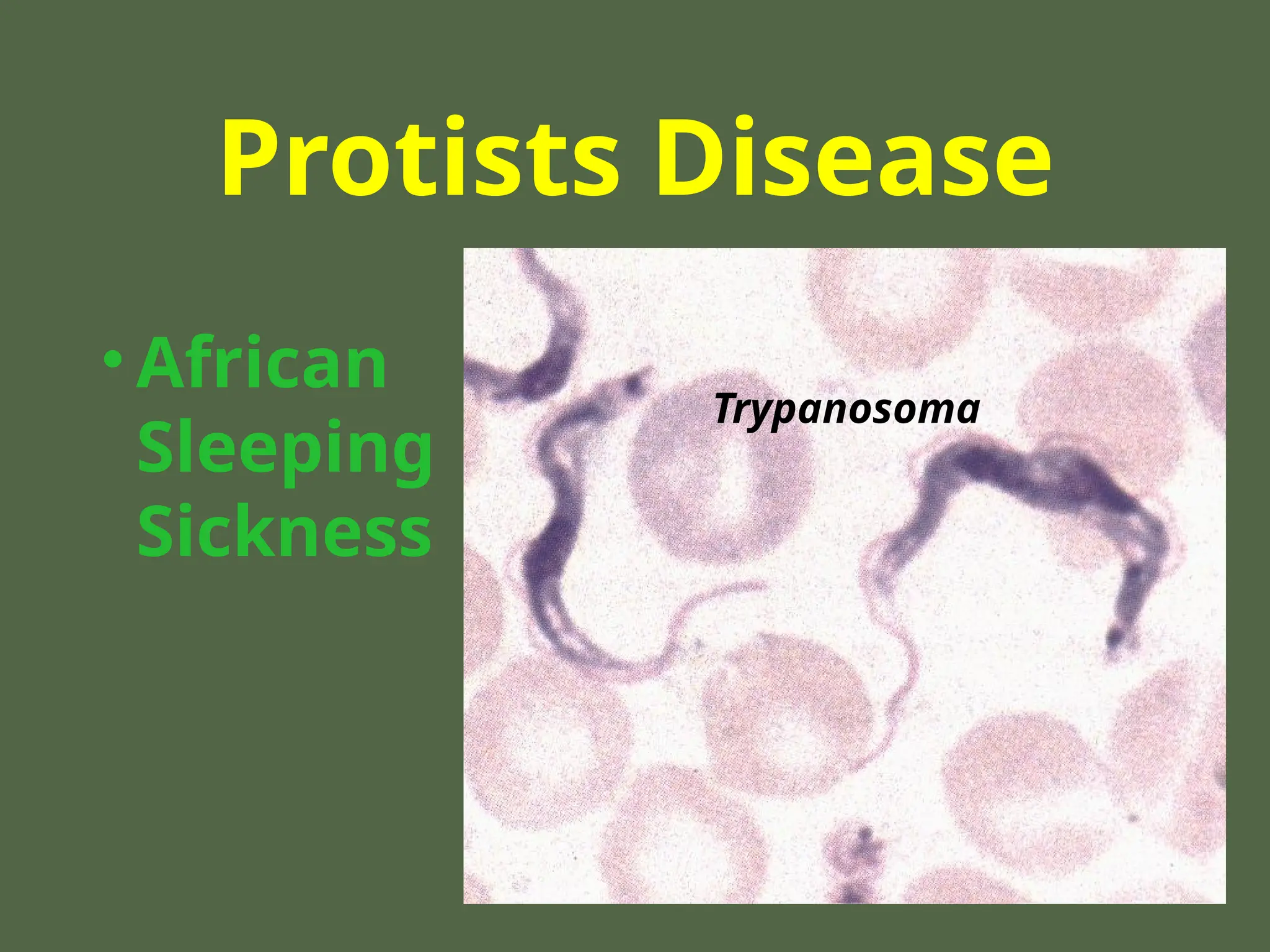 Protists Disease
• African
Sleeping
Sickness
Trypanosoma
 