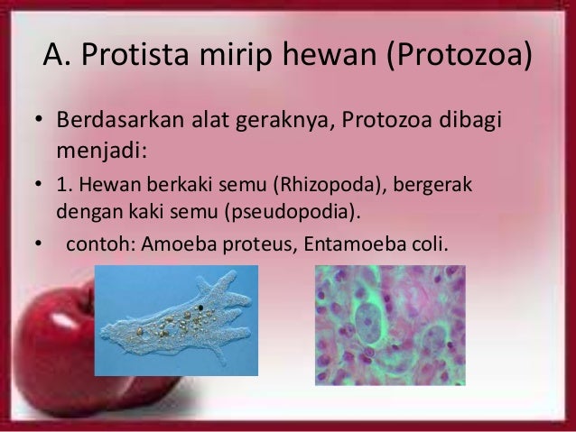 Kingdom Protista