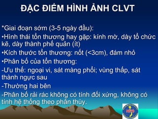 ĐẶC ĐIỂM HÌNH ẢNH CLVT
*Giai đoạn sớm (3-5 ngày đầu):
•Hình thái tổn thương hay gặp: kính mờ, dày tổ chức
kẽ, dày thành phế quản (ít)
•Kích thước tổn thương: nốt (<3cm), đám nhỏ
•Phân bố của tổn thương:
-Ưu thế: ngoại vi, sát màng phổi; vùng thấp, sát
thành ngực sau
-Thường hai bên
-Phân bố rải rác không có tính đối xứng, không có
tính hệ thống theo phân thùy.
 