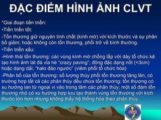 ĐẶC ĐIỂM HÌNH ẢNH CLVT
*Giai đoạn tiến triển:
•Tiến triển tốt:
-Tổn thương giữ nguyên tính chất (kính mờ) với kích thước và sự phân
bố giảm; hoặc không còn tổn thương, phổi trở về bình thường.
•Tiến triển xấu:
-Hình thái tổn thương: các vùng kính mờ chồng lấp với dày tổ chức kẽ
tạo hình ảnh lát đá vỉa hè “crazy paving”; đông đặc dạng nốt (<3cm)
hoặc dạng dải; “halo đảo ngước” (viêm phổi tổ chức hóa)
-Phân bố của tổn thương: số lượng thùy phổi tổn thương tăng lên, có
trường hợp tất cả các phân thùy đều chứa tổn thương; tổn thương có
xu hướng lan từ ngoại vi vào trong tâm các phân thùy; một số đám tổn
thương nhỏ có xu hướng hợp lưu tạo thành vùng tổn thương với kích
thước lớn hơn nhưng không thấy hệ thống hóa theo phân thùy.
 