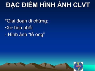 ĐẶC ĐIỂM HÌNH ẢNH CLVT
*Giai đoạn di chứng:
•Xơ hóa phổi
- Hình ảnh “tổ ong”
 