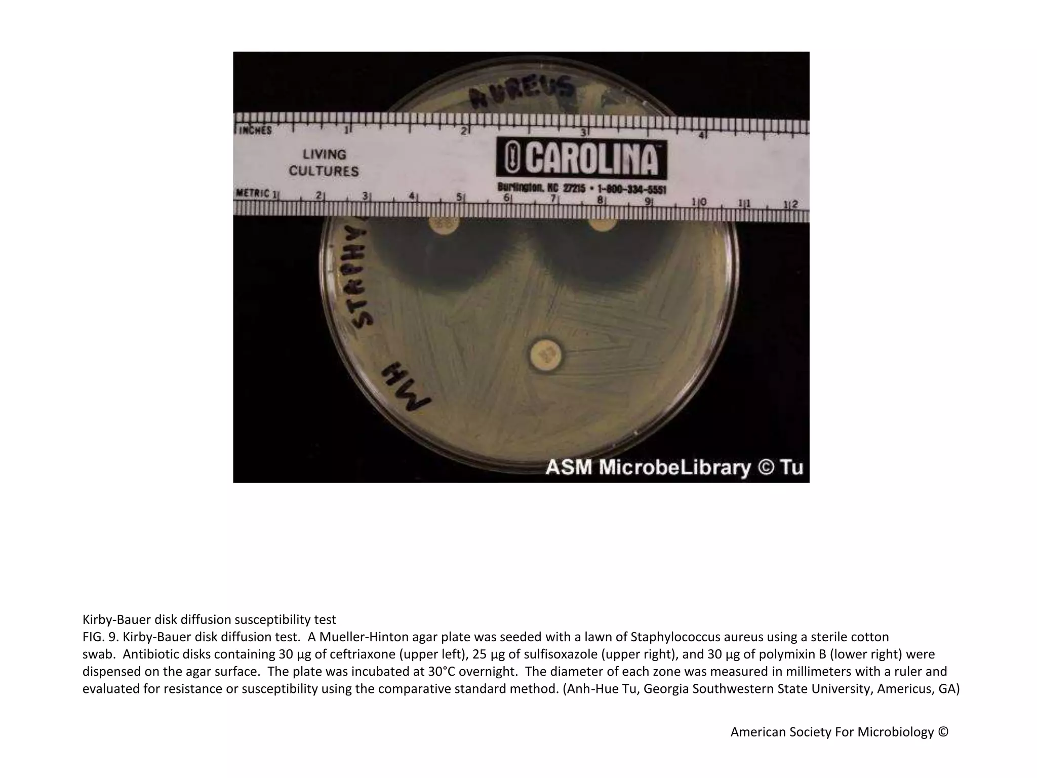 KIRBY-BAUER-DISK-DIFFUSION-SUSCEPTIBILITY-TEST.pptx