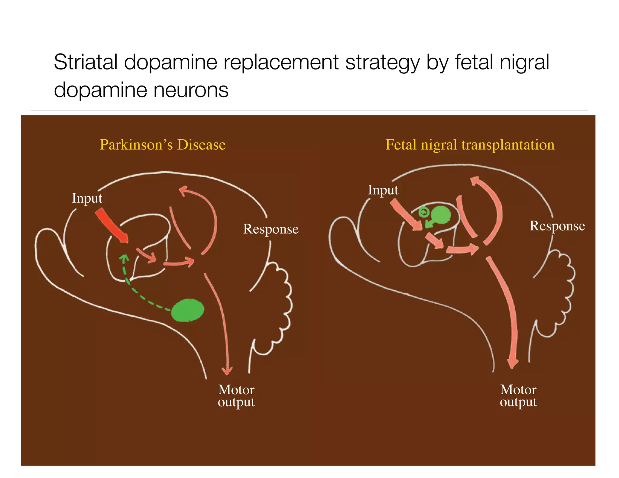 Dopamine Replacement: Filling the Void with Creativity
